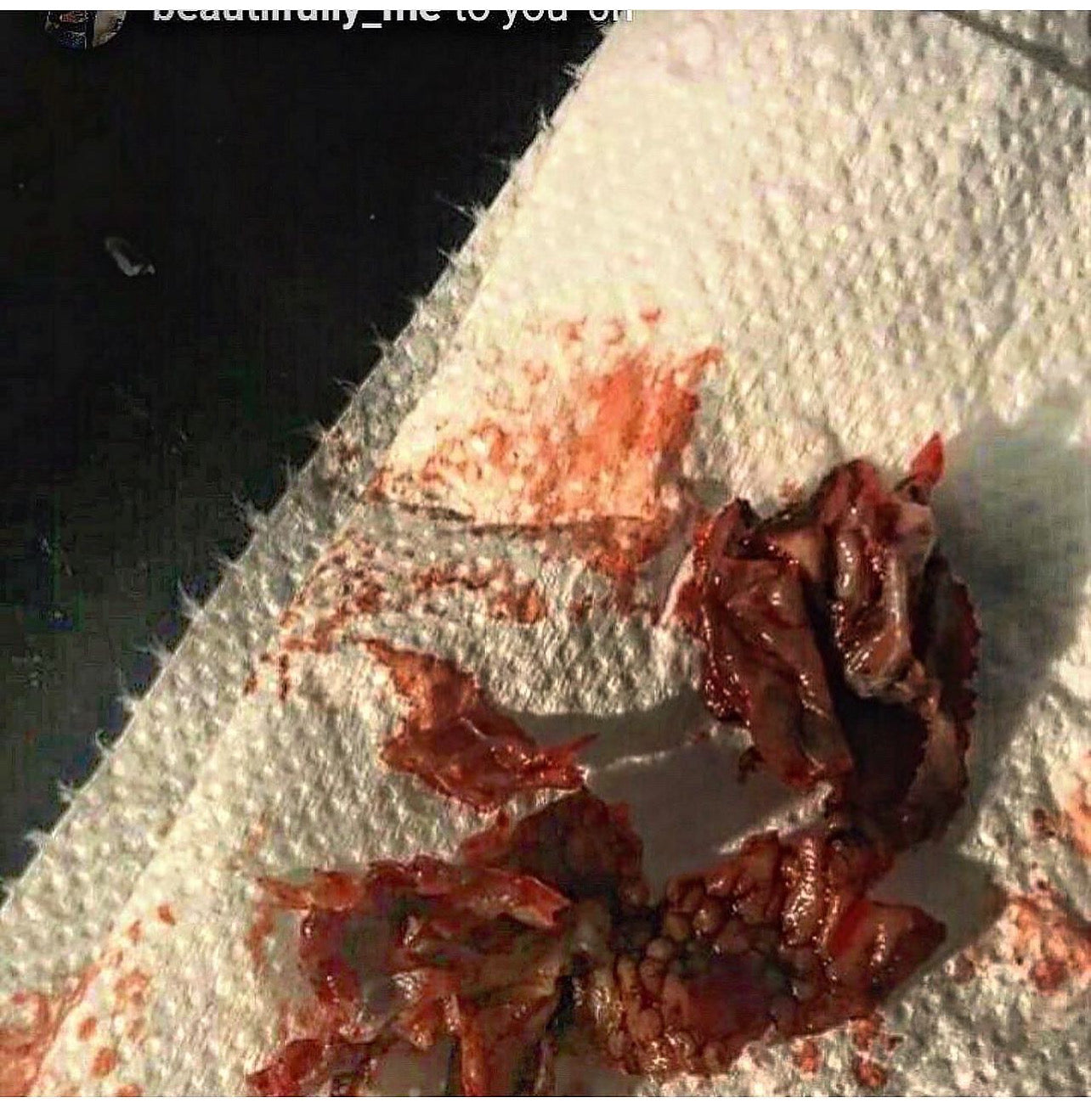 Newly Formulated Vaginal Detox Pearl BUY 1 GET ONE FREE