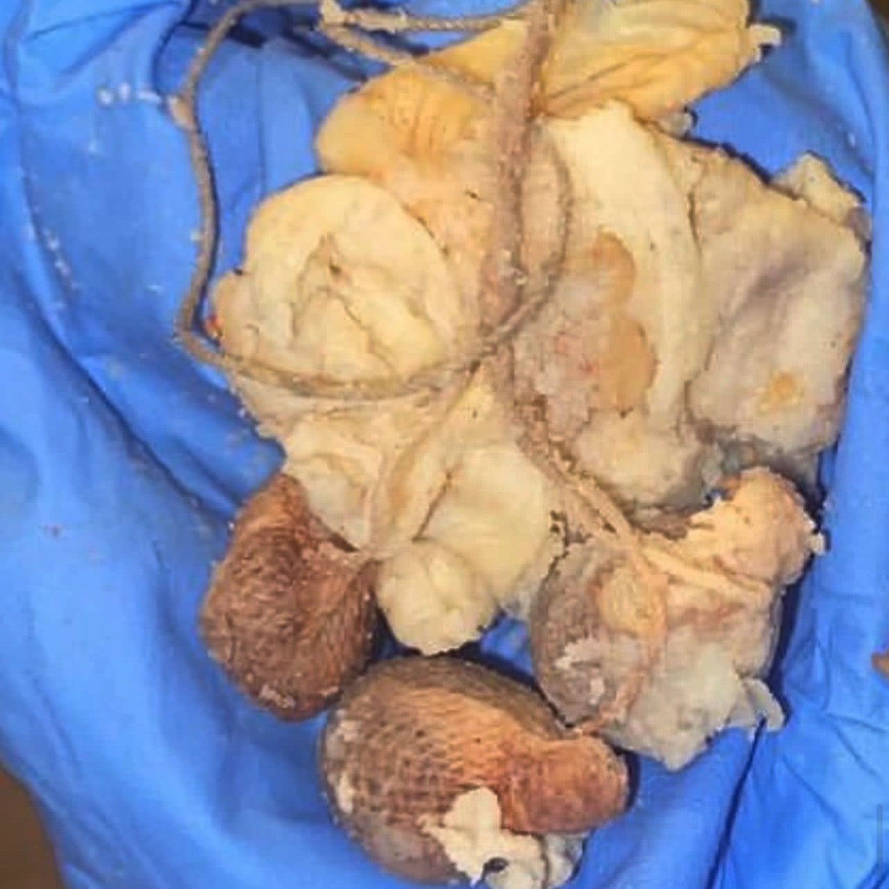 Newly Formulated Vaginal Detox Pearl BUY 1 GET ONE FREE