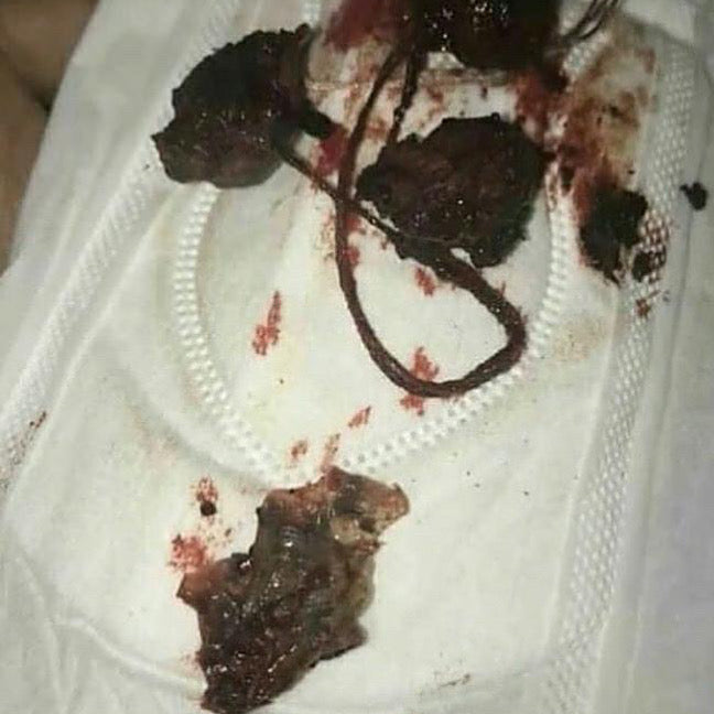 Newly Formulated Vaginal Detox Pearl BUY 1 GET ONE FREE